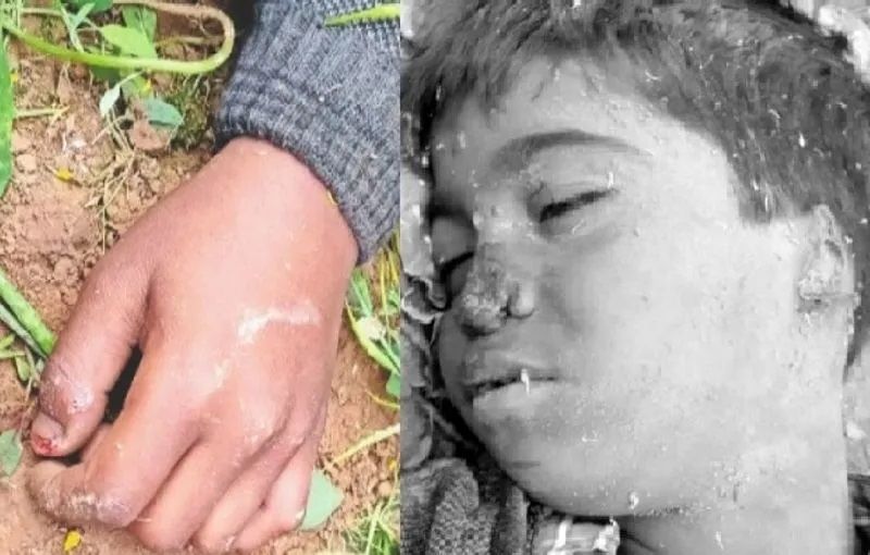 पुलिस के मुताबिक निर्मल बाबू (मृतक) आरोपी को बार-बार महाराज कहकर चिढ़ाता था। इससे वह काफी नाराज था। घटना के दिन आरोपी निर्मल बाबू को अपने साथ सरसों के खेत में बहाने से लेकर गया। जहां गला दबाकर उसकी हत्या कर दी।