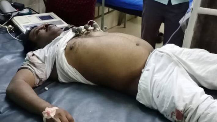 union minister shripad naik injured in a road accident KPP union minister shripad naik injured in a road accident KPP