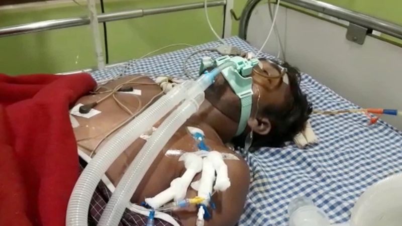बताते हैं कि सुखराम यादव कपड़े बदल रहा था। तभी, विनोद ने दाल मिल में इस्तेमाल होने वाली पाइप से उसके इंटरनल पार्ट में एयर प्रेशर हवा भर दी।
