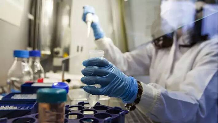 19 workers in iron factory tested covid 19 Positive 19 workers in iron factory tested covid 19 Positive