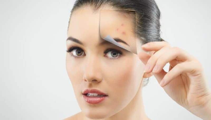 reasons behind acne can be identify by its spot