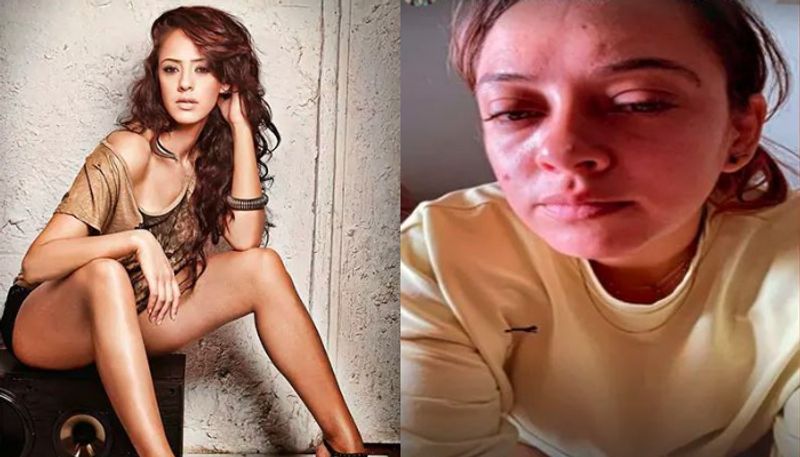 তবে বর্তমানে হ্যাজেল কিচের য়ে ছবি প্রকাশ্যে এসেছে তা দেখে উদ্বেগে তার ভক্তরা। কিন্তু কেনও এমন ঘটনা তা এখনও অজানা সকলের কাছে।