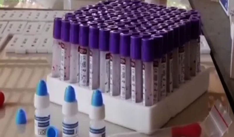 साथ ही अगर आपने हाल ही में कोई वैक्सीन लिया है या किसी तरह के हेल्थ इश्यू से जूझ रहे हैं, तो भी आपको कोवैक्सीन नहीं लेना चाहिए। वरना आपके ऊपर इसका नेगेटिव असर पड़ेगा।
