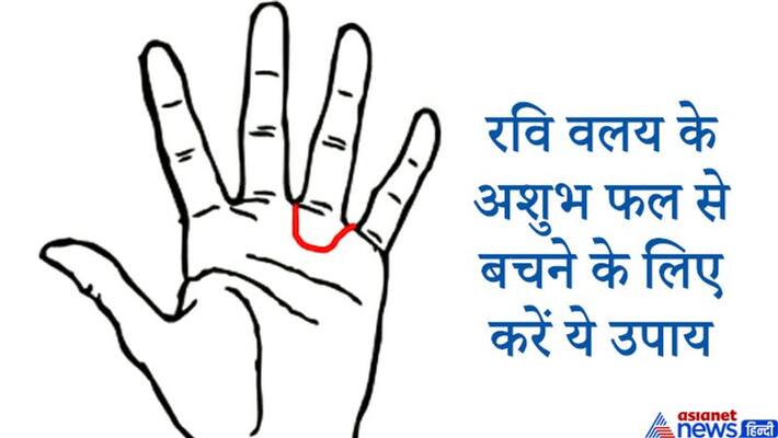 This line, formed near the Sun Mount in the palm, is inauspicious, do this remedy for auspicious results KPI This line, formed near the Sun Mount in the palm, is inauspicious, do this remedy for auspicious results KPI