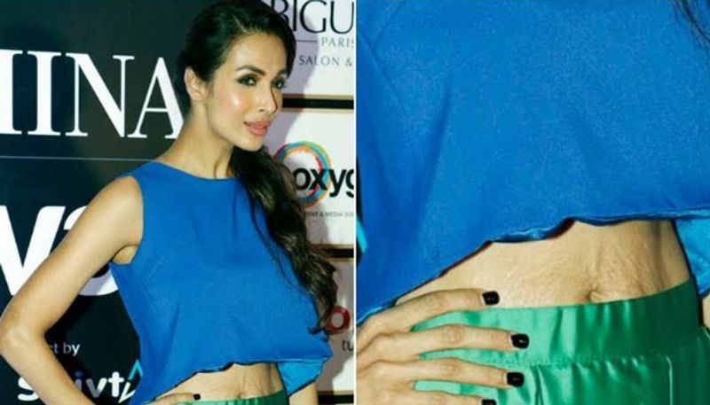 Internet users took no time to start trolling her for visible stretchmarks. One user wrote, "Tummy se budhapa dikh gaya."