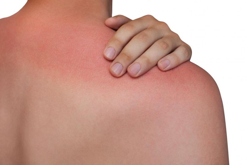 Get Rid of Tan: All the ingredients used in ubtan have coolant properties that help relieve your skin from excess heat and tan. They remove dead skin and help get a soft and supple skin.