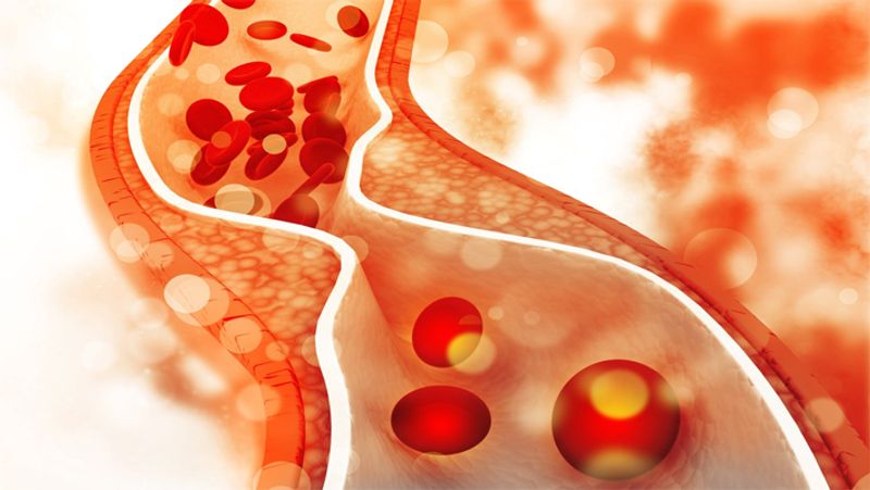 डॉक्टर्स के मुताबिक गांगुली ‘ट्रिपल वेसल डिजीज’ (Triple Vessels Disease) से पीड़ित हैं। जिसके कारण उनके हार्ट में खून पूरी तरह नहीं पहुंच रहा था और उन्हें हार्ट अटैक आया था। बता दें कि 2 जनवरी को दादा को घर में एक्सरसाइज करने के दौरान हार्ट अटैक आया था। जिसके बाद उन्हें कोलकाता के वुडलैंड्स हॉस्पिटल (woodlands hospital) में एडमिट करवाया गया था। 