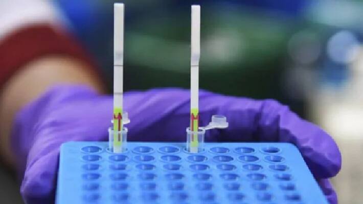 840 new corona cases reported in andhra pradesh 840 new corona cases reported in andhra pradesh