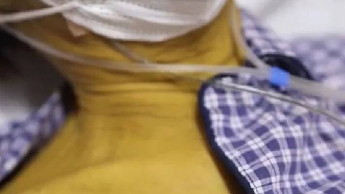 skin turned deep yellow color due to chronic smoking skin turned deep yellow color due to chronic smoking