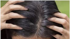 what causes premature grey hair