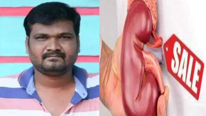bus conductor offers to sell kidney on facebook after salary deducted 50% in corona kph bus conductor offers to sell kidney on facebook after salary deducted 50% in corona kph