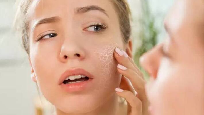 try these facepacks for dry skin try these facepacks for dry skin