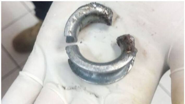 ring get stuck in penis as man attempt to impress girl friend on valentines day ring get stuck in penis as man attempt to impress girl friend on valentines day
