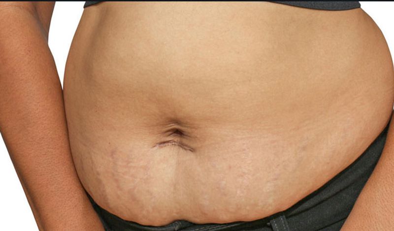 Lose belly fat like a pro with these five perfect tips plus one you never knew about