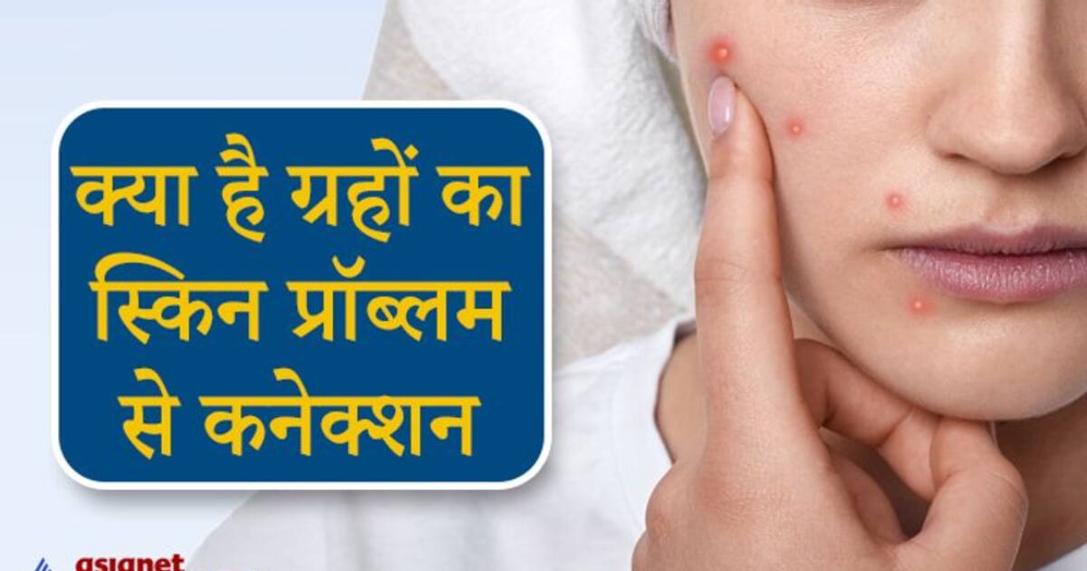 इन 4 ग रह क क रण ह त ह त वच स स ब ध त र ग कर सकत ह य आस न उप य These 4 Planets May Cause Skin Related Diseases Do These Easy Remedies Kpi