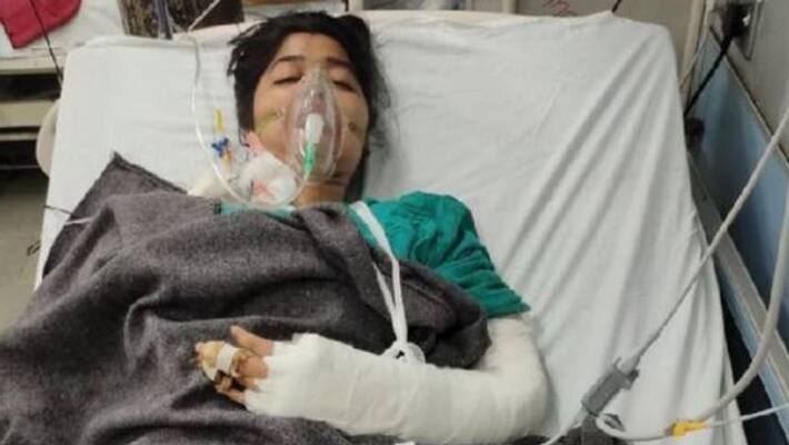 madhya pradesh news bhopal drunken husband becomes haughter cuts his wifes hand kpr madhya pradesh news bhopal drunken husband becomes haughter cuts his wifes hand kpr