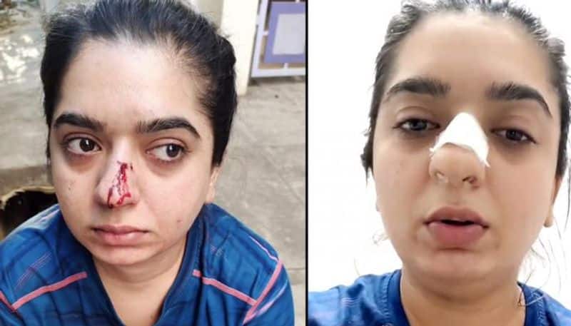 Bengaluru Police Arrests Zomato Delivery Boy Who Assaulted Beauty Influencer