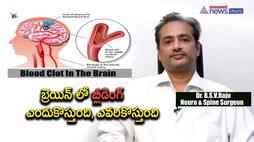 reasons for brain hemorrhage, diagnosis and cure