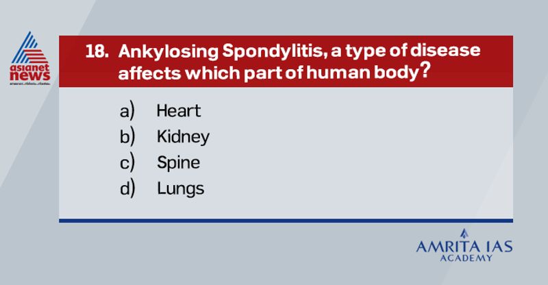 Answer (c) Ankylosing Spondylitis (AS) is a type of arthritis in which there is a long-term inflammation of the joints of the spine. If left untreated, it leads to paralysis. Symptoms of this disease are recurring pain in spine in early adulthood, reduced flexibility leading to hunched-forward posture of spine. Treatment includes medication, physiotherapy and in rare cases, surgery.