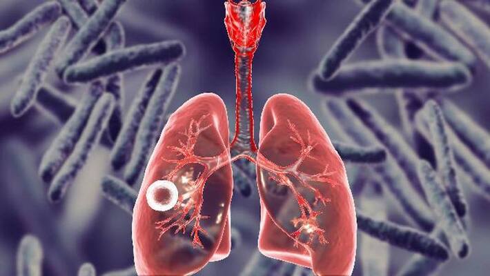 In India, 21.4 lakh new cases of TB were reported in 2021, an 18% increase from the previous year. In India, 21.4 lakh new cases of TB were reported in 2021, an 18% increase from the previous year.