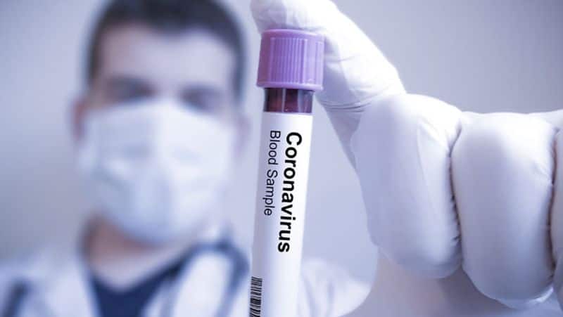 Coronavirus affects 74 students at Vandalur Private College