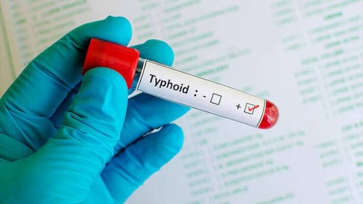 Typhoid in those who ate at a party given by the winners of a football match Typhoid in those who ate at a party given by the winners of a football match