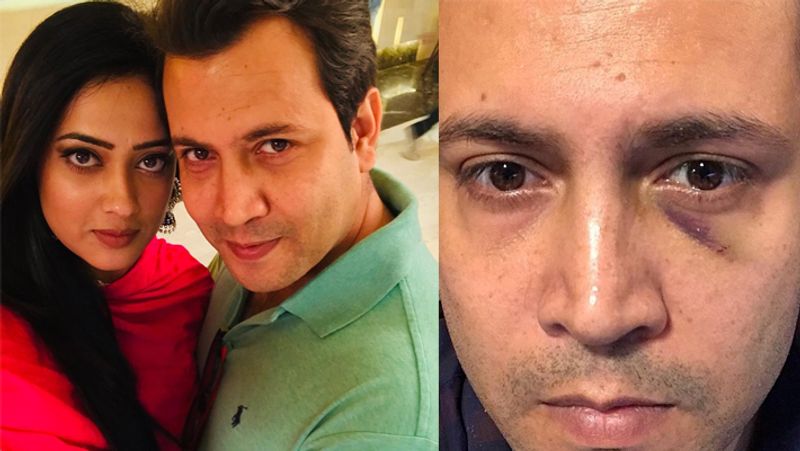 स्पॉटब्वॉय को दिए एक इंटरव्यू में अभिनव ने कहा- मैंने श्वेता को कभी नहीं पीटा, सिवाय उस थप्पड़ के जिसका जिक्र पलक ने खुद अपने लेटर में किया था। मैं उस थप्पड़ के लिए दोनों से माफी मांग चुका हूं। सारा कन्फ्यूजन श्वेता ने क्रिएट किया है ताकि यह साबित कर सकें कि मैंने उनके साथ घरेलू हिंसा की है जो कि सच नहीं है। मैं कभी महिलाओं को पीटने वाला नहीं रहा हूं।