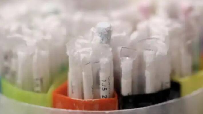 Gujarat : COVID-19 patient dies day after hospital collects his sperm as per HC order - bsb Gujarat : COVID-19 patient dies day after hospital collects his sperm as per HC order - bsb