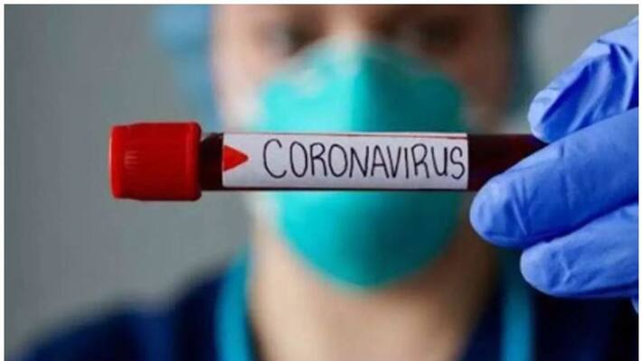Take care of yourself in the time of covid 19 outbreak Take care of yourself in the time of covid 19 outbreak