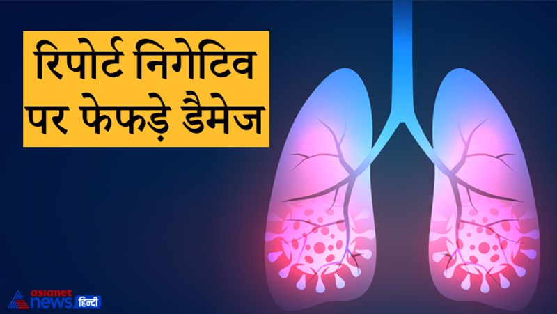 रिपोर्ट निगेटिव पर फेफड़े डैमेज
कोरोना के नए वैरिएंट के कारण संक्रमण का खतरा बढ़ता जा रहा है। इस बार कई ऐसे मरीज भी सामने आए हैं जिनमें लक्षण नजर आने के बावजूद उनकी रिपोर्ट तो निगेटिव आई है, लेकिन उनकी सीटी स्कैन की रिपोर्ट बताती है कि उनके फेफड़े डैमेज हो गए हैं।