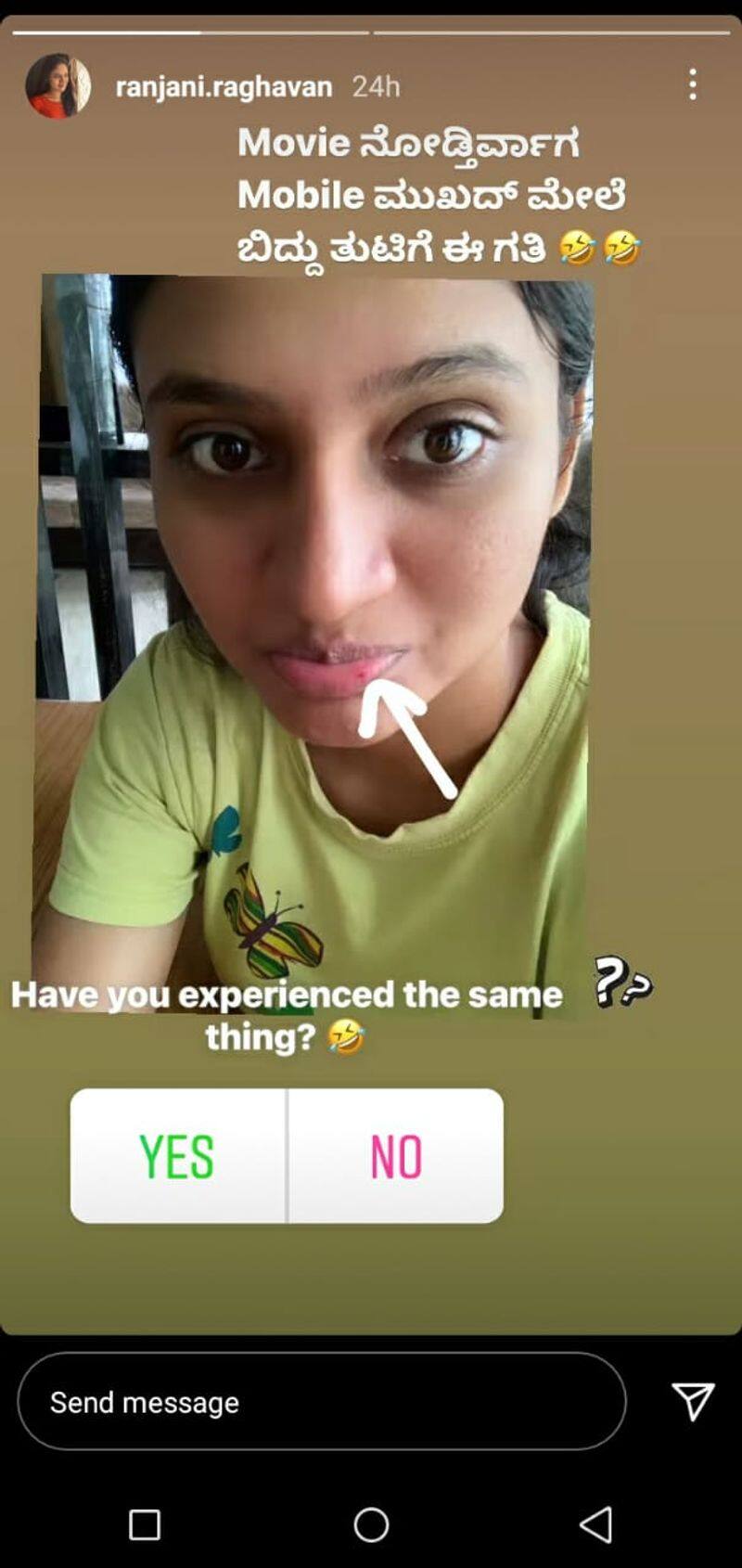 Kannadathi Actress Ranjani Raghavan shares photo of her lips injury dpl