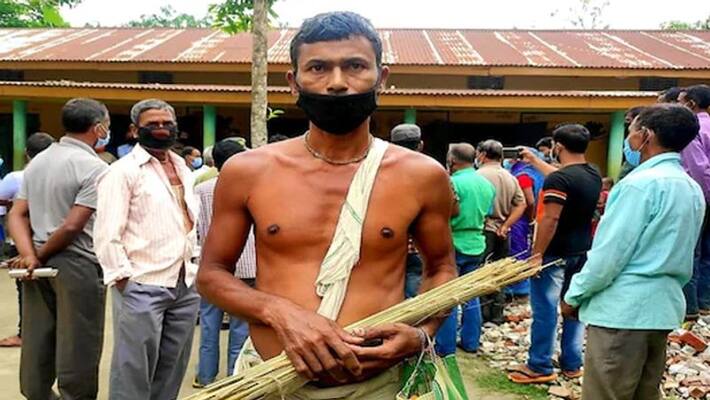 bengal Violence They Tried to Kill Me as I Voted for BJP says party worker KPP bengal Violence They Tried to Kill Me as I Voted for BJP says party worker KPP