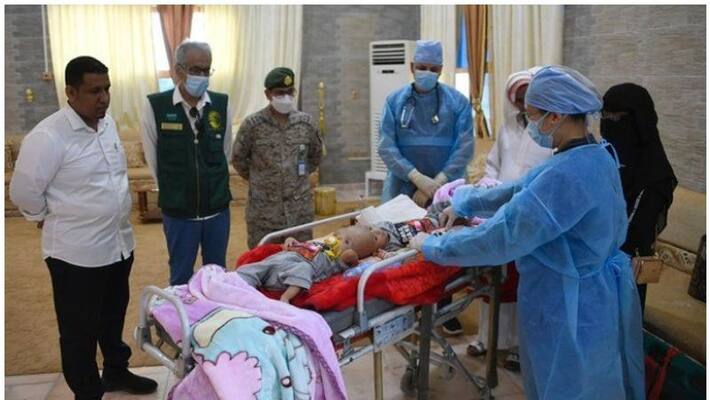 Yemeni conjoined twins arrived in Saudi Yemeni conjoined twins arrived in Saudi