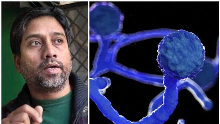 professor hani babu have black fungus disease will be shifted to hospital professor hani babu have black fungus disease will be shifted to hospital