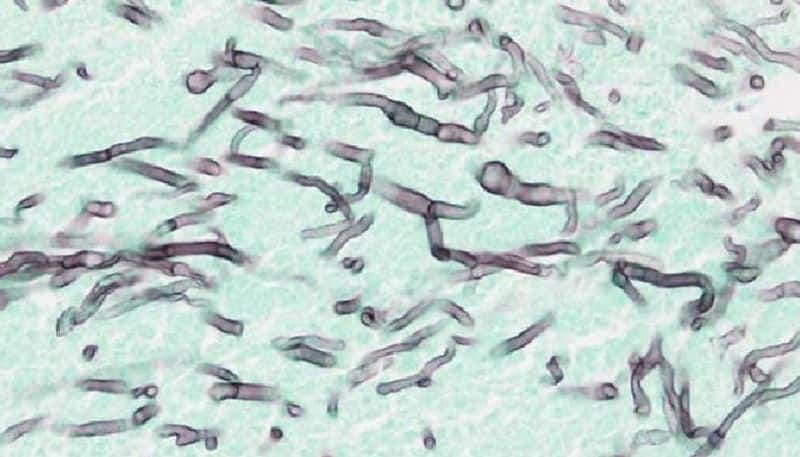 aspergillosis fungul cases are reporting in gujarat