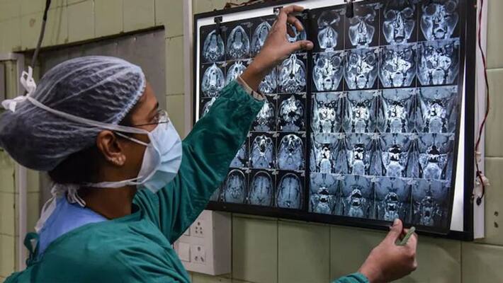 Green fungus infection patient found in Indore bpsb Green fungus infection patient found in Indore bpsb