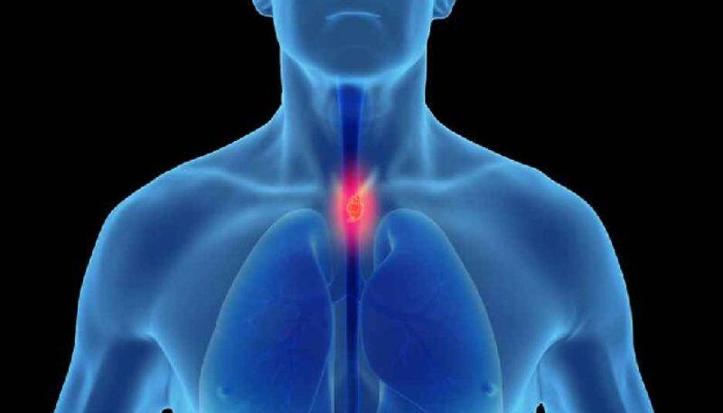 lifestyle mistakes which may lead to esophageal cancer