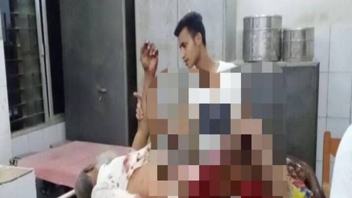 Bomb blast in Araria, one man's right hand blown off, two live bombs recovered asa Bomb blast in Araria, one man's right hand blown off, two live bombs recovered asa