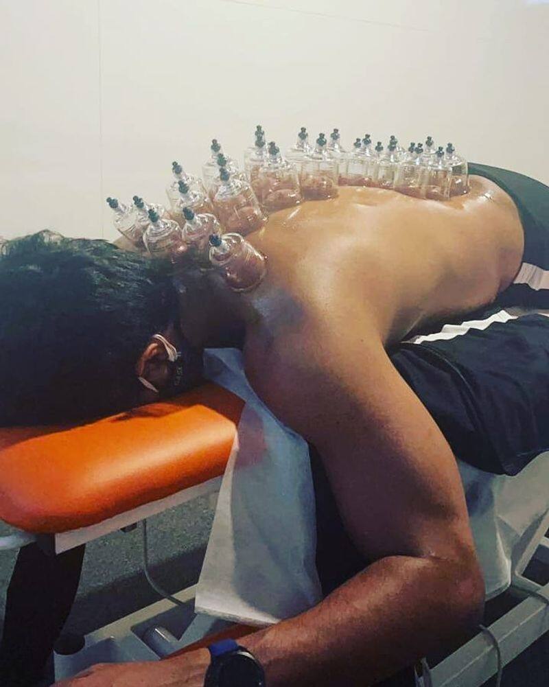 actor vishnu vishal cupping therapy photo viral in internet