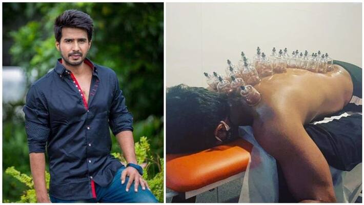 actor vishnu vishal cupping therapy photo viral in internet actor vishnu vishal cupping therapy photo viral in internet