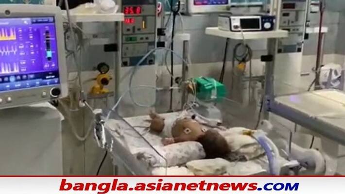 Coronavirus outbreak Two-day-old baby in East Burdwan is infected with covid 19 bsm Coronavirus outbreak Two-day-old baby in East Burdwan is infected with covid 19 bsm