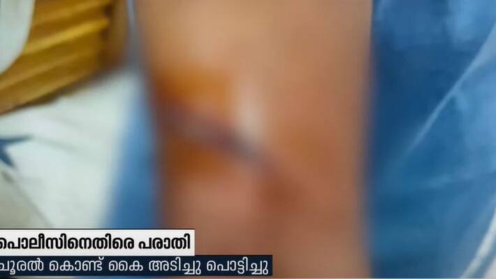 complaint against police for attacking man in kollam complaint against police for attacking man in kollam