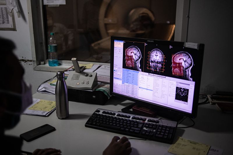 ग्रीन फंगस क्यों कहा जाता है?
श्री अरबिंदो इंस्टीट्यूट ऑफ मेडिकल साइंसेज (SAIMS) में रेसपेरेट्री विभाग के एचओडी डॉक्टर रवि दोसी ने कहा, ऐसा नहीं है कि शरीर में फंगस संक्रमण होने से उसका रंग भी दिखता है। इसका नाम ग्रीन फंगस इसलिए है क्योंकि लैब में टेस्टिंग के दौरान इसका कल्चर ऐसा दिखता है।
