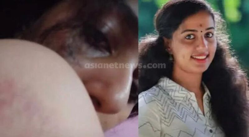 ఆయుర్వేద వైద్య విద్యార్థి అయిన విస్మయ నాయర్ తన మెసేజ్ లలో భర్త కిరణ్ కుమార్ తన జుట్టు పట్టుకుని లాగి, ముఖం మీద పిడిగుద్దులు కురిపించాడని తెలిపింది. దీనికి సంబంధించిన ఫొటోలూ షేర్ చేసింది. 