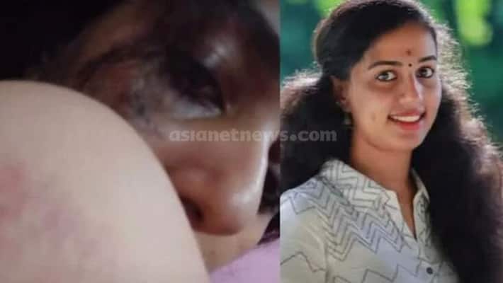 Vismaya death leads social media discussion on Dowry Vismaya death leads social media discussion on Dowry