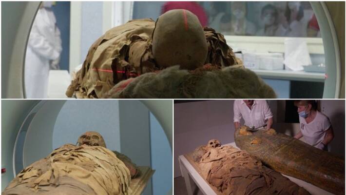 3000 years Egyptian mummy CT scan by Milan hospital 3000 years Egyptian mummy CT scan by Milan hospital