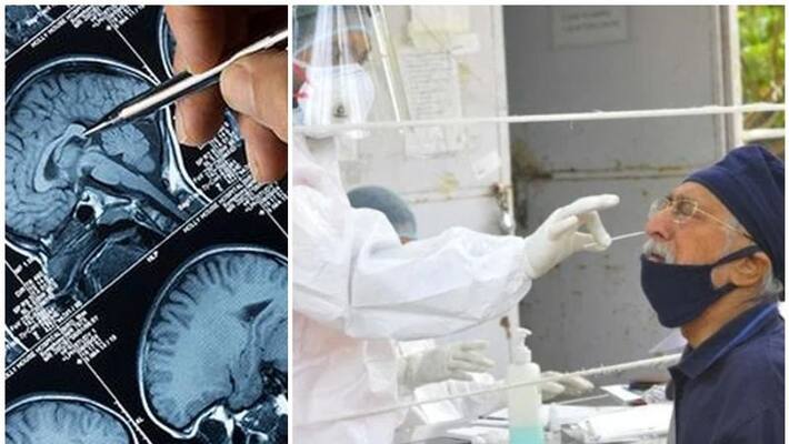 covid in elderly may cause loss of grey matter, dementia says new oxford study covid in elderly may cause loss of grey matter, dementia says new oxford study