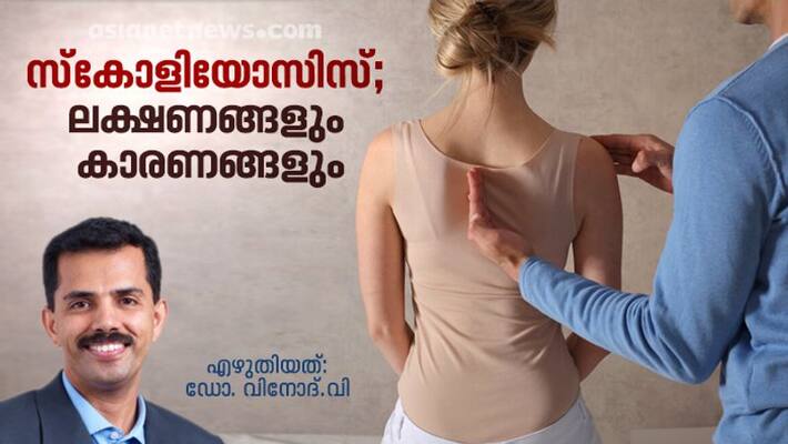 Signs and symptoms of scoliosis Signs and symptoms of scoliosis