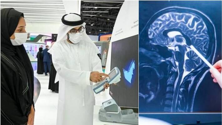 UAE launched rapid blood test to detect head injuries in 15 minutes UAE launched rapid blood test to detect head injuries in 15 minutes