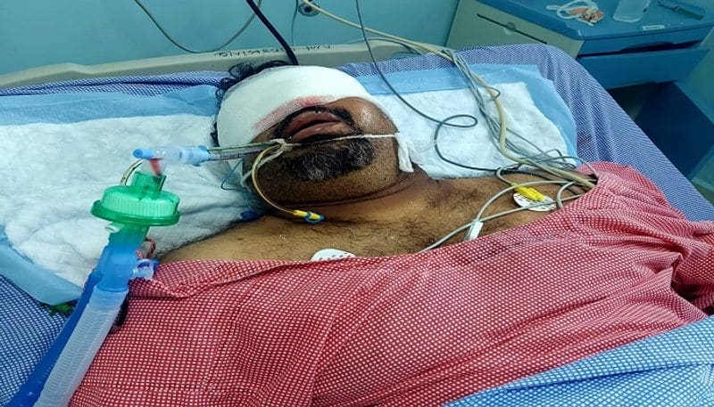 Telugu actor Kathi Mahesh severely injured in car accident in Nellore vcs